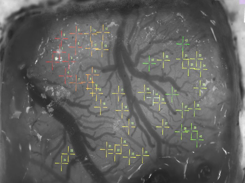 ciblage neuronal de la machine à coudre