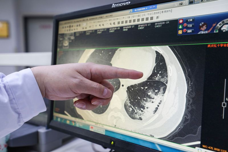 Médecin pointe vers CT Scan
