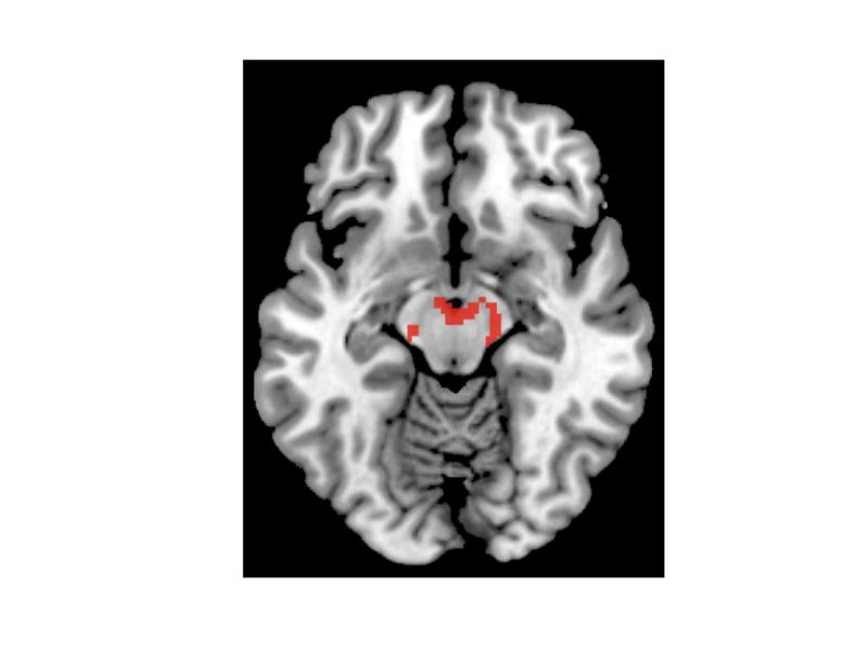 skenování fmri