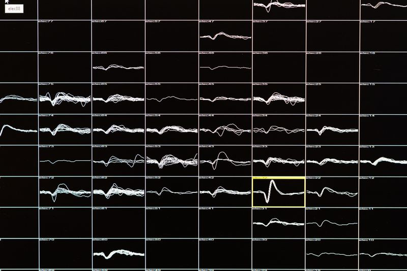 Potentiels d
