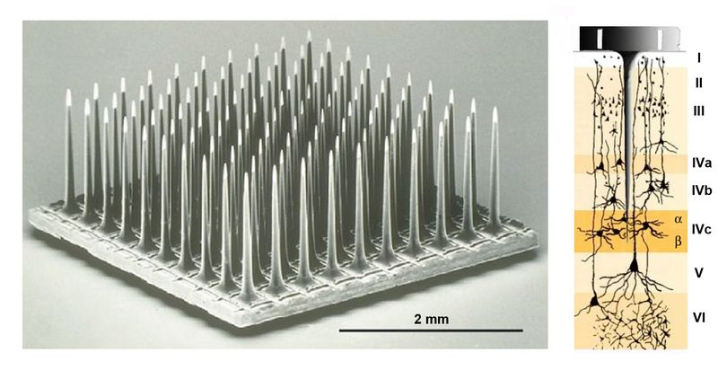 Le réseau implanté