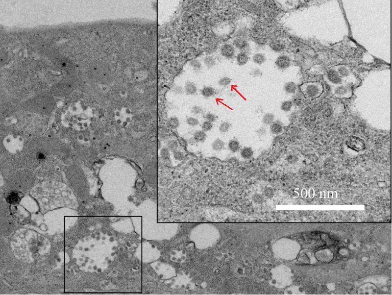 coronavirus 2019