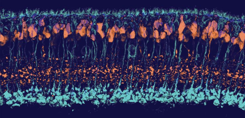 Micrographie de cellules bipolaires en bâtonnets et cônes