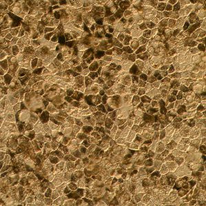 cellules utilisées dans les essais cliniques d