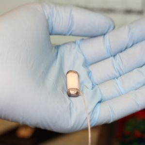 bioelektronisches Implantat