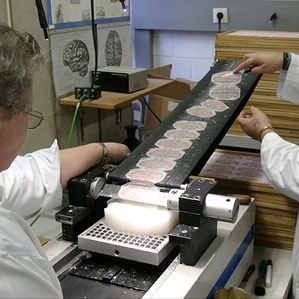 Forscher schneiden ein Gehirn